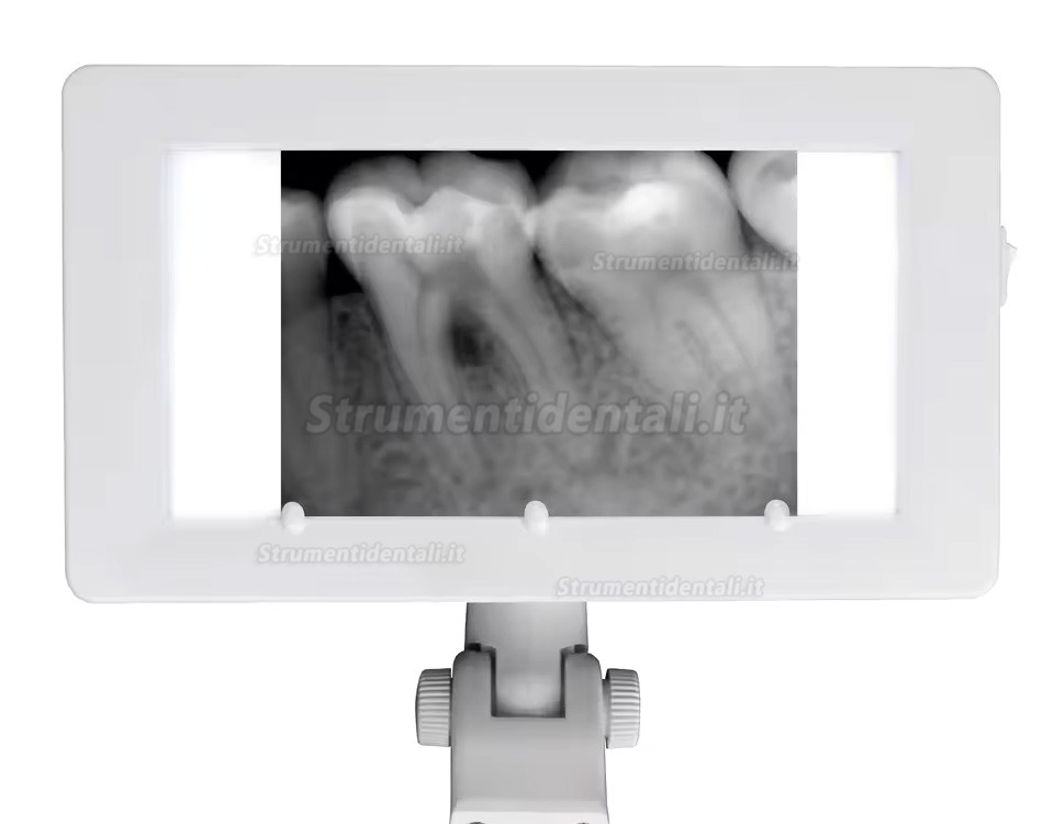 Radiografia negatoscopio 24 V per poltrona odontoiatrica